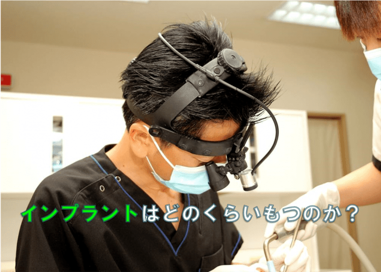 インプラント 寿命 群馬 前橋