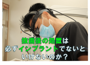 群馬 歯科 前橋 高崎 伊勢崎 桐生 太田 インプラント ブリッジ 入れ歯 義歯 抜歯 欠損補綴