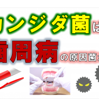 歯科 群馬 前橋 高崎 伊勢崎 桐生 太田 歯周病の原因 カンジダ菌 真菌 歯周内科 ペリオバスター