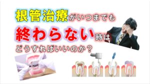 歯科 群馬 前橋 高崎 伊勢崎 桐生 太田 根管治療 治療期間 セカンドオピニオン