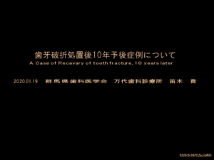 歯科 群馬 前橋 高崎 伊勢崎 桐生 太田 歯を抜かずに残す 根管治療 インプラント 歯周病