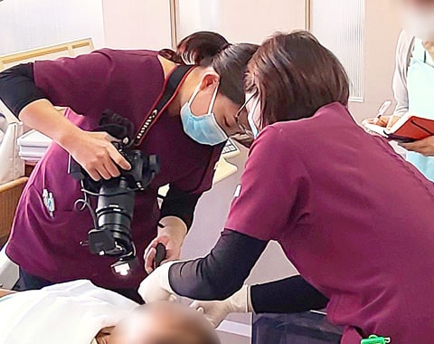 口腔内写真撮影